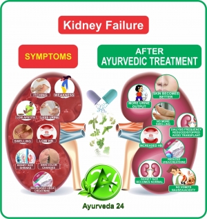 Ayurvedic treatment for kidney failye